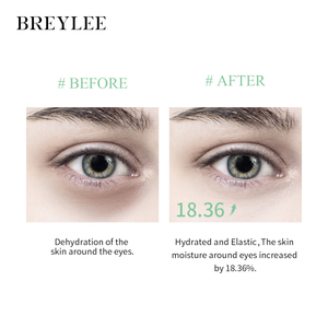 แผ่นมาส์กใต้ตา BREYLEE สูตรอโลเวร่าออร์แกนิค เรตินอล ไฮยาลูรอนิค แอซิด คอลลาเจน ช่วยเติมความชุ่มชื้น ลดรอยคล้ำใต้ตา พร้อมรับผลิตโลโก้ตามสั่ง - Product Image 5