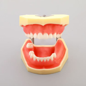 Modèle dentaire Dt M2030 : Dents anatomiques manquantes pour l'enseignement des implants et la science médicale - Product Image 1