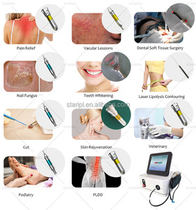 <span class=keywords><strong>Precio</strong></span> <span class=keywords><strong>de</strong></span> fábrica Beijing Starlight Red Blood Spider Vein Removal 980Nm Diodo Láser Máquina <span class=keywords><strong>de</strong></span> <span class=keywords><strong>eliminación</strong></span> vascular Alivio del dolor - Product Image 3