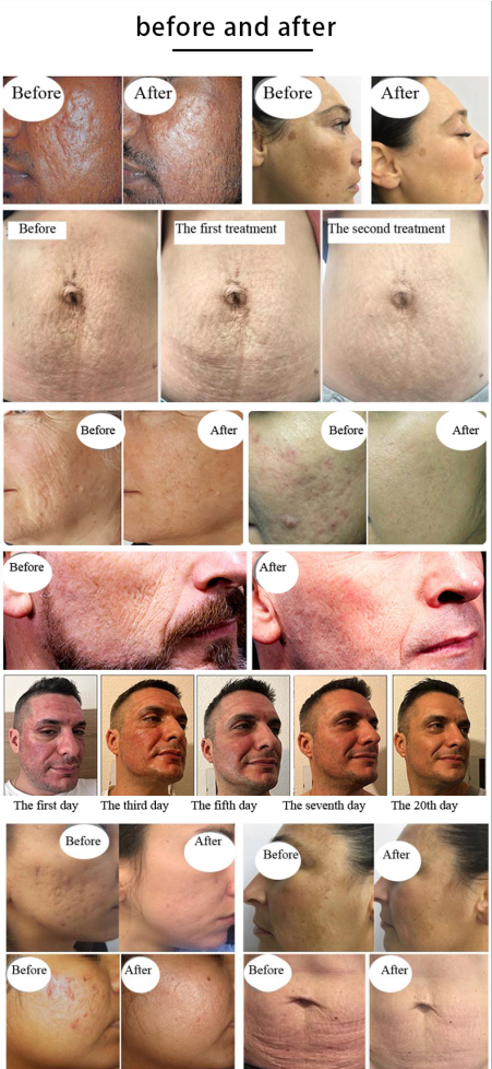 clear and brilliant machine