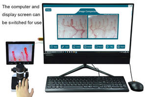 HDズーム<span class=keywords><strong>USB</strong></span>顕微鏡<span class=keywords><strong>400X</strong></span>拡大皮膚毛細管マイクロ循環イメージング用 - Product Image 3