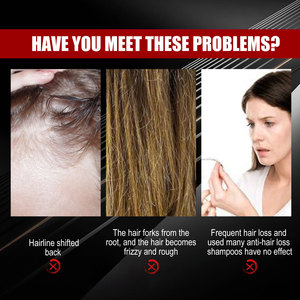 Sérum Capillaire Naturel au Gingembre et Riz Noir de Marque Privée – Huile de Croissance Anti-Chute pour Hommes et <span class=keywords><strong>Femmes</strong></span> - Product Image 4