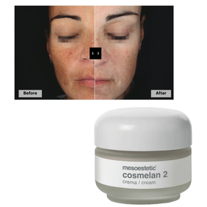Mesoestetic <span class=keywords><strong>Cosmelan</strong></span> <span class=keywords><strong>2</strong></span> Crème Blanchissante Visage Soins Personnels Espagne Original - Product Image 1