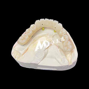 Pont Implantable Premium |   Base en titane avec couronne en céramique pour une restauration dentaire fiable | pour laboratoire ou clinique - Product Image 5