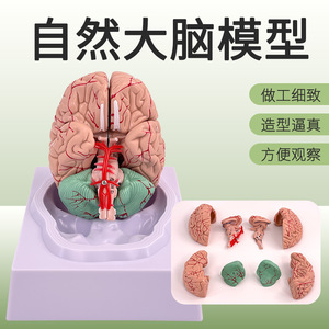 Modèle d'artère cérébrale, modèle d'anatomie du cerveau, modèle de cerveau, modèle de tige cérébrale, modèle de structure du cerveau, neurologie - Product Image 2
