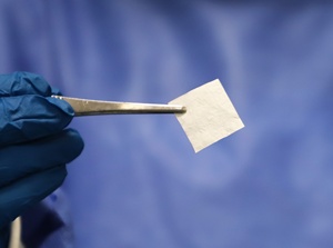 Biosi dentale GTR membrana Sterile collagene foglio osso innesto collagene membrana dentale - Product Image 5