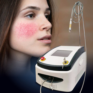 Tần số cao 980nm Diode <span class=keywords><strong>Laser</strong></span> Spider tĩnh mạch mạch máy loại bỏ vẻ đẹp mạch máu mao mạch thiết bị loại bỏ - Product Image 2