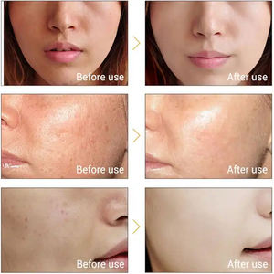 韓国のグルタチオンコウジ酸スキンケアセラムスキンホワイトニングフェイシャルセラムアンチエイジングダークスポットリムーバー - Product Image 3