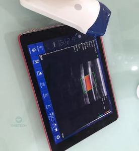 C37A Portable 128 Elemento Inalámbrico vascular USG Ultrasonido Sonda de ultrasonido lineal - Product Image 2