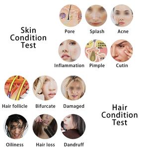 Mini saç tarayıcı ekipmanları cilt ve saç analiz cihazı kafa derisi saç makinesi - Product Image 4