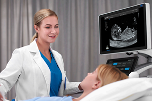 Échographe P60 Exp 4D 5D Sonoscape, appareil d'échographie, diagnostic par échographie, équipement médical pour hôpital - Product Image 3