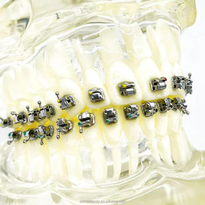 Apparecchi ortodontici Yamei di alta qualità, bracket autoliganti con strumento. - Product Image 4
