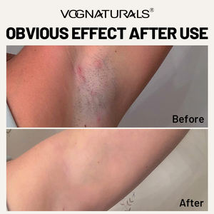 Tampons de traitement des poils incarnés à l'acide glycolique, lactique et salicylique pour la prévention des boutons de rasoir et les soins après-<span class=keywords><strong>rasage</strong></span> pour le visage, le corps et la zone du bikini - Product Image 6