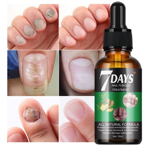 Suero Fuerte y Efectivo para Hongos en las Uñas, Solución de 7 Días, Repara y Nutre las Uñas Dañadas, Suero Natural a Base de Hierbas - Product Image 1