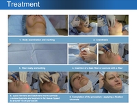 Endotight 980nm 1470nm Haute Puissance