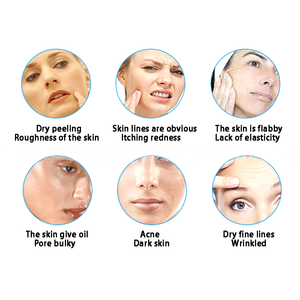 Oksijen tedavisi yüz çözümleri o2toderm beyazlatıcı krem nemlendirici yüz kremi - Product Image 4