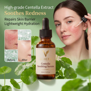 Suero Calmante de Centella de Marca Privada OEM, Extracto de Alta Calidad, Calma Instantáneamente el Enrojecimiento, Repara la Barrera Cutánea para Piel Sensible, Spa - Product Image 4