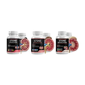 Natural Dissolver ginjal Chanca Piedra seledri ekstrak biji kapsul suplemen - Product Image 5