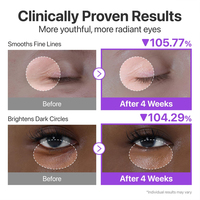 Crème pour les yeux coréenne électrique Nad+ Peptides Rétinol Niacinamide Éclaircissante Anti-cernes Anti-rides Gel pour le contour des yeux