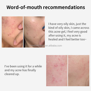 Produit prêt à l'emploi le plus vendu transfrontalier: le gel quotidien <span class=keywords><strong>anti</strong></span>-<span class=keywords><strong>bouton</strong></span> Youbuy pour la peau avec élimination des pigments - Product Image 4