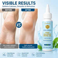 Gel adoucissant pour les callosités des pieds OEM, soin adoucissant en profondeur pour les pieds rugueux, secs et gercés, exfolie les peaux mortes, menthe fraîche rafraîchissante