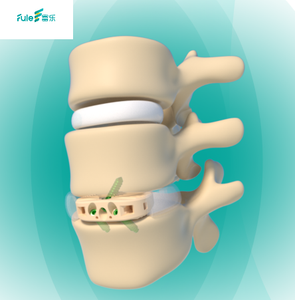 กรงกระดูกสันหลังส่วนคอ PEEK คุณภาพสูงแบบรุกรานต่ำสำหรับการผ่าตัดกระดูกสันหลัง ขายส่ง - Product Image 4