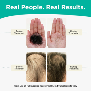 Champú y Acondicionador para Cabello Fino y Quebradizo, Fórmula con Fito-Cafeína, Promueve el Crecimiento Natural para el Cabello Fino de Mujer - Product Image 5