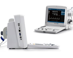 Appareil d'échographie vétérinaire portable Edan DUS60 noir et blanc pour l'examen clinique des chiens, des chats et des chevaux - Product Image 4