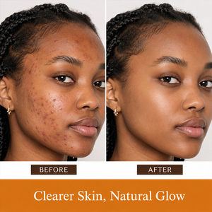 Jabón Facial Personalizado con Logotipo, Aclarante, Antimanchas, Limpiador, Minimizador de Poros, Jabón Negro Africano Natural Hecho a Mano - Product Image 2