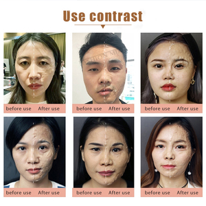 Máscara <span class=keywords><strong>de</strong></span> enzima <span class=keywords><strong>de</strong></span> elevación <span class=keywords><strong>de</strong></span> etiqueta privada, máscara Facial <span class=keywords><strong>de</strong></span> bruja milagrosa, máscara <span class=keywords><strong>de</strong></span> contorno <span class=keywords><strong>de</strong></span> escultura facial reafirmante en V - Product Image 6