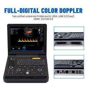 Escáner de Ultrasonido Doppler a Color para Detección del Latido Fetal en Clínicas, Económico y de Bajo Costo - Product Image 1