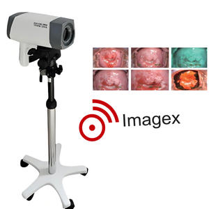 <span class=keywords><strong>Vaginoscope</strong></span> électronique numérique Colposcope vidéo pour examen gynécologique - Product Image 4