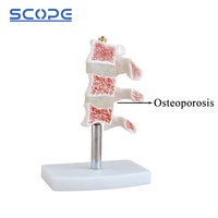 Instrumento de enseñanza de maniquí médico, simulador anatómico de esqueleto, modelo de osteoporosis humana de 3 vértebras, SC-A1022