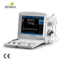 Ecógrafo Veterinario Edan DUS60 con Dos Sondas, Ultrasonido Portátil en Blanco y Negro para Animales Pequeños y Grandes, Clínicas Veterinarias y Hospitales