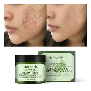 Custom rivate Label Organic Anti Acne Pimple Treatment Face Cream Natural Herbal Acne Removal Cream