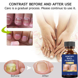 Tratamiento Fortalecedor <span class=keywords><strong>de</strong></span> Uñas <span class=keywords><strong>de</strong></span> Marca Privada OEM, Reparación para Infecciones por Hongos en Uñas <span class=keywords><strong>de</strong></span> Manos, Pies y Dedos, Hongos en las Uñas Homtopy - Product Image 2