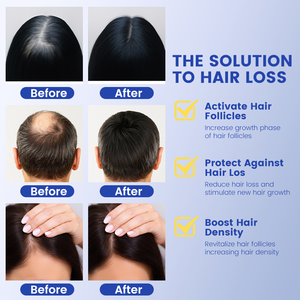 Olio per <span class=keywords><strong>la</strong></span> Crescita <span class=keywords><strong>dei</strong></span> <span class=keywords><strong>Capelli</strong></span> GHK-Cu + AHK-Cu 30ml all'Ingrosso OEM Trattamento per <span class=keywords><strong>la</strong></span> Ricrescita Prevenzione della <span class=keywords><strong>Caduta</strong></span> <span class=keywords><strong>dei</strong></span> <span class=keywords><strong>Capelli</strong></span> Siero per <span class=keywords><strong>Capelli</strong></span> con Peptidi di Rame - Product Image 4