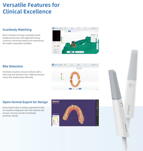 Escáner <span class=keywords><strong>Intraoral</strong></span> Dental <span class=keywords><strong>Shining</strong></span> <span class=keywords><strong>3D</strong></span> Aoralscan Lync con IA - Product Image 6