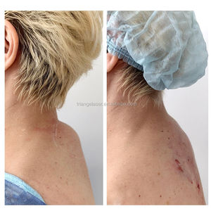 เครื่องกำจัดไขมันด้วย1470nm TR-B 980nm เครื่องกำจัดไขมันที่คางสองชั้นเครื่องเอนโดเลเซอร์ยกกระชับใบหน้ารุ่นยอดนิยม - Product Image 5