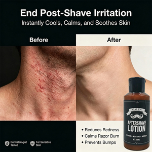 Loción para Después del Afeitado para Hombre de Marca Privada, Fórmula <span class=keywords><strong>Natural</strong></span> para Calmar la Irritación y Reparar la Piel - Product Image 2