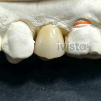 Bloque de Zirconia Multicapa Ivista UT-ML, 60% de Translucidez, 650 MPa, Directo de Fábrica, para Diseño de Carillas Dentales