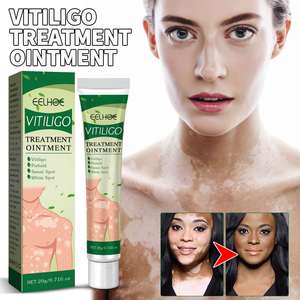 EELHOE Pommade de Traitement du Vitiligo Élimine les <span class=keywords><strong>Taches</strong></span> <span class=keywords><strong>Blanches</strong></span> Teigne Leucoplasie Crème pour la Dermatite 20ml - Product Image 3