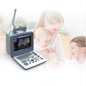 Special Design Full Digital LED Machine <b>Pocket</b> Portable Laptop Veterinary Ultrasound Scanner High-capacity Video Replay BW300 - Product Image 2