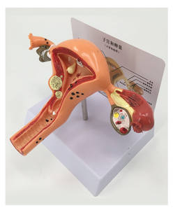 Modelo de Entrenamiento de Patología Médica: Maniquí de Agrandamiento Uterino de PVC de Tamaño Real Avanzado para Uso en Escuelas de Medicina y Hospitales - Product Image 4