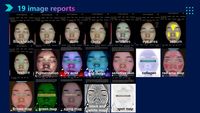 Appareil d'analyse cutanée rapide en 10 secondes, prend en charge 23 langues, stockage cloud illimité, instrument de test facial
