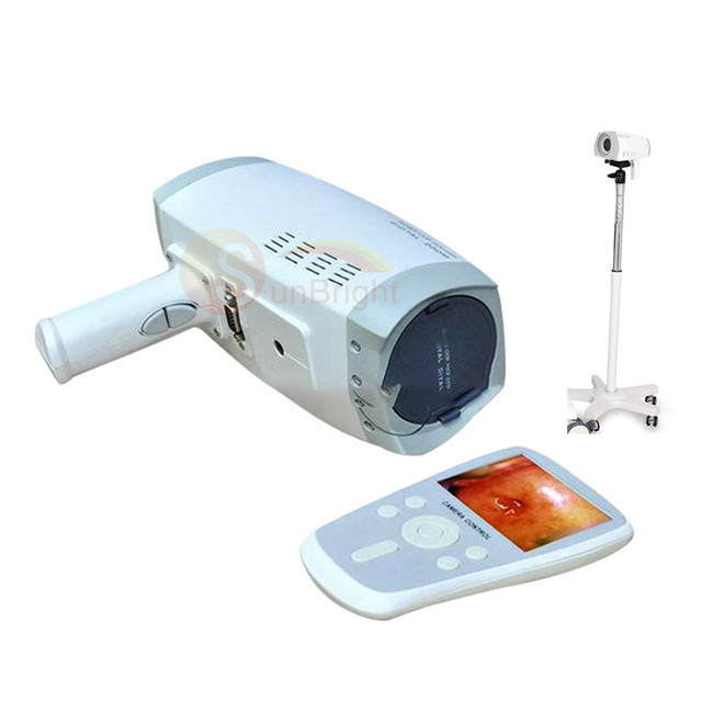Portable Handheld Medical HD Gynecology Video Colposcopy Electronic Video Colposcope for Women Colposcopy for Gynecology