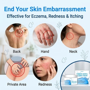Crème anti-eczéma OEM, éclaircissante, à base de plantes, <span class=keywords><strong>antifongique</strong></span>, apaisante en profondeur, nouvelle crème chinoise, meilleure pommade anti-démangeaisons - Product Image 5