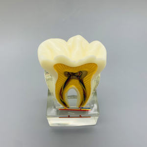 نموذج الفم 6 مرات نموذج عصب الأسنان مع تشريح الأعصاب للتعليم والعرض - Product Image 4