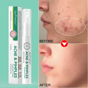 Sylicylic Acid 15g Anti-inflammatory Lightening Restoring Acne Treatment Antibacterial Face Cream