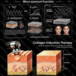 Fabricante de Máquinas Faciales de Belleza Personalizadas, Equipo de Belleza de Nivel Profesional para Tensar la Piel y Levantar el Rostro, Uso Dermatológico en Salón - Product Image 2